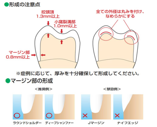 形成の注意点